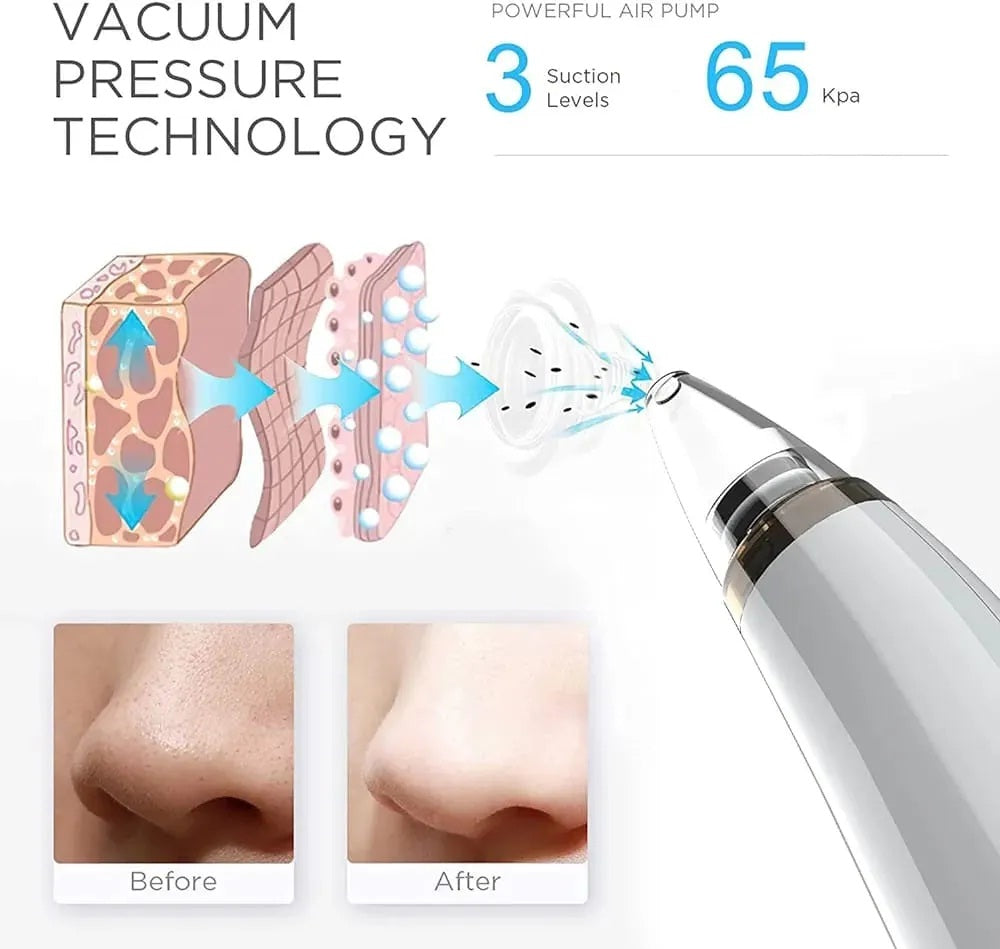 6 in 1 Blackhead Remover USB Rechargeable Derma Suction Blackhead Removal Machine