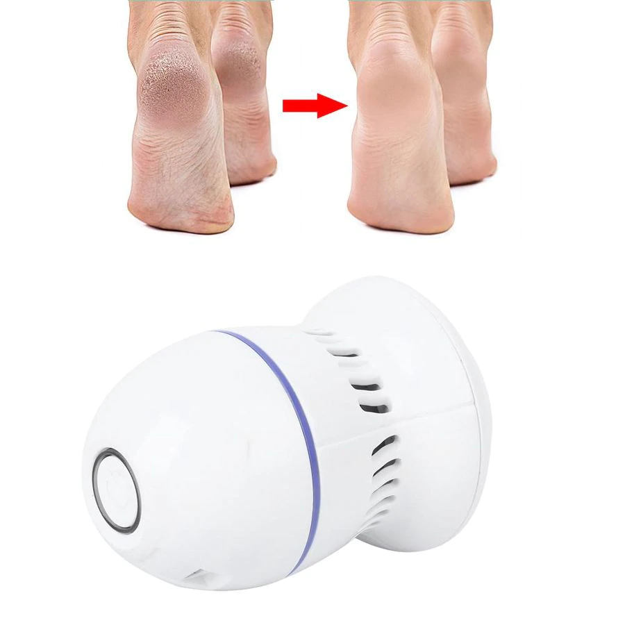 Pedi Vac by Ped Egg - Callus Remover for Feet with Built-in Vacuum  97298050626 